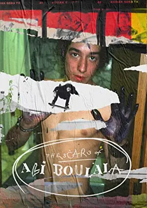 Scars of Ali Boulala