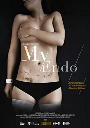 MyEndo